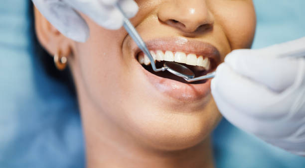 Best Emergency Wisdom Teeth Removal in Moriarty, NM